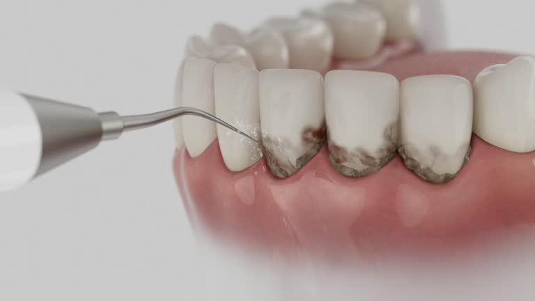 Reliable Dental contractor in De Graff, OH by Smile Center Dentistry